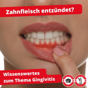 Zahnfleischentzündung