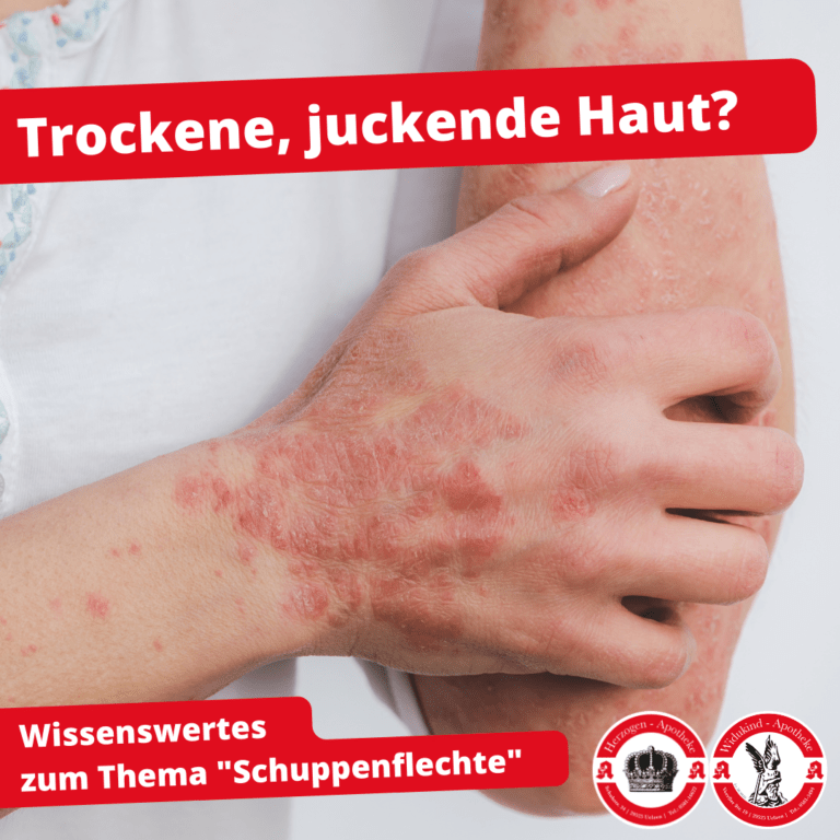 Schuppenflechte