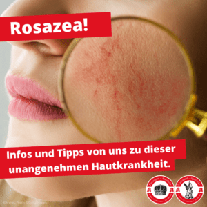Rosazea-Beratung in der Widukind-Apotheke Uelzen